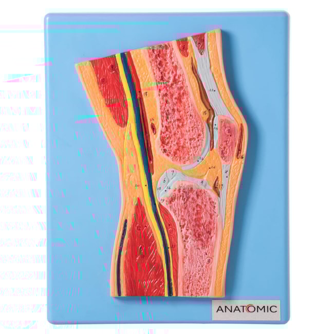 Secção Mediana da Articulação do Joelho-728c861f-4ed2-48ee-ac92-895c4932e372