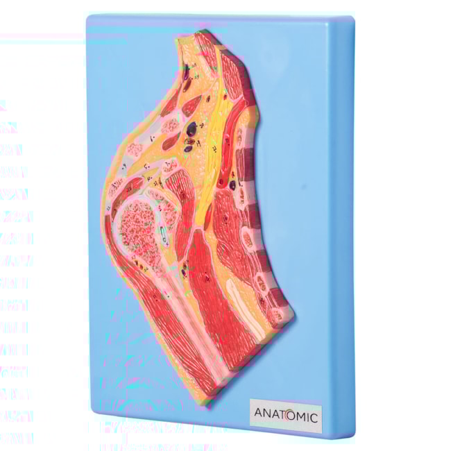 Secção Mediana da Articulação do Ombro-314537a5-4107-489d-aac2-c61c807e6d6f