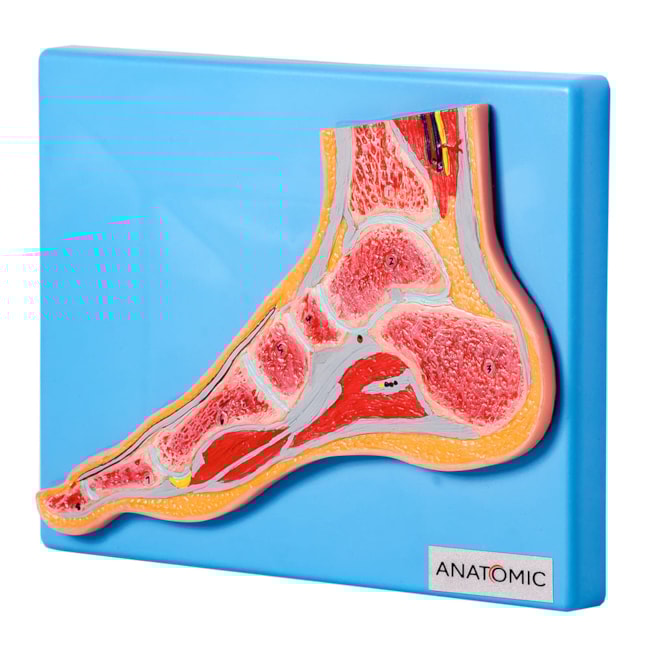 Secção Mediana da Articulação do Pé-33aff9ed-8c16-47fb-9b32-fdb70d754860