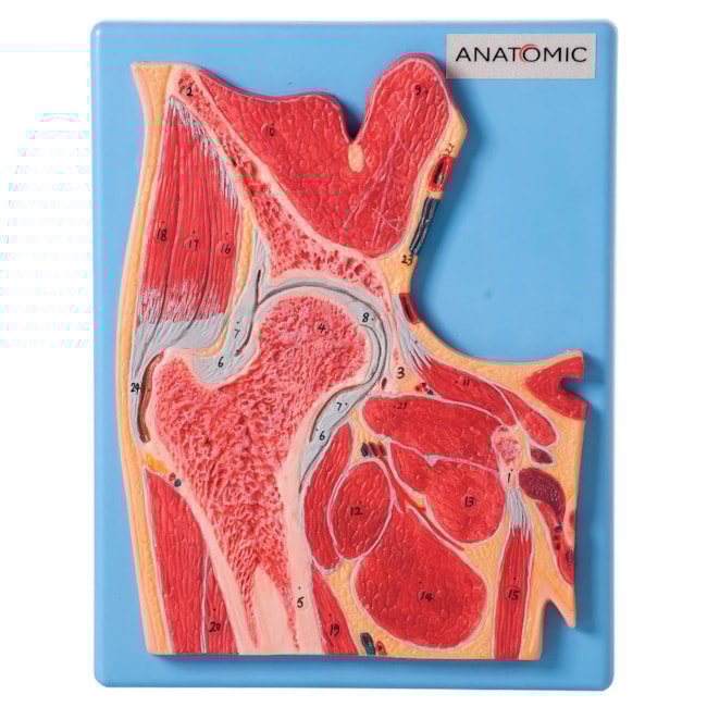 Secção Mediana da Articulação do Quadril-100a8a69-e9bb-4b5a-95dd-4a7dd6ceb875