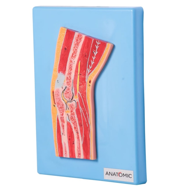 Secção Mediana Do Cotovelo-22c22084-3cec-4948-84cd-cf9f1d06f97a