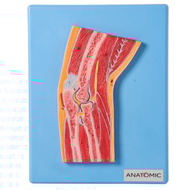 Secção Mediana Do Cotovelo-98a832f9-092b-4130-aaf7-6b0aee330bc0