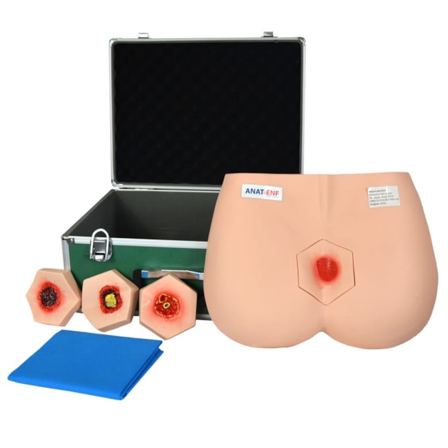 Simulador de Estágios de Úlceras por Pressão-59afb0de-d4c0-4846-8ff6-9fffe358725e