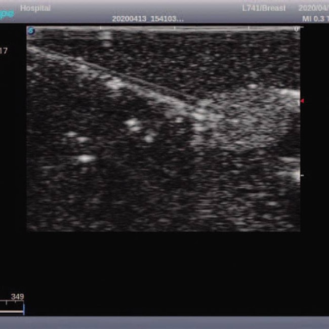 Simulador de Mamas para Exame Clínico e Ultrassonografia Mamária-24303b0a-b06b-4906-8d93-da67172d8e17