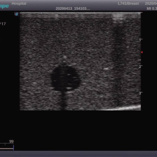 Simulador de Mamas Vestíveis para Exames e Ultrassonografia Mamária