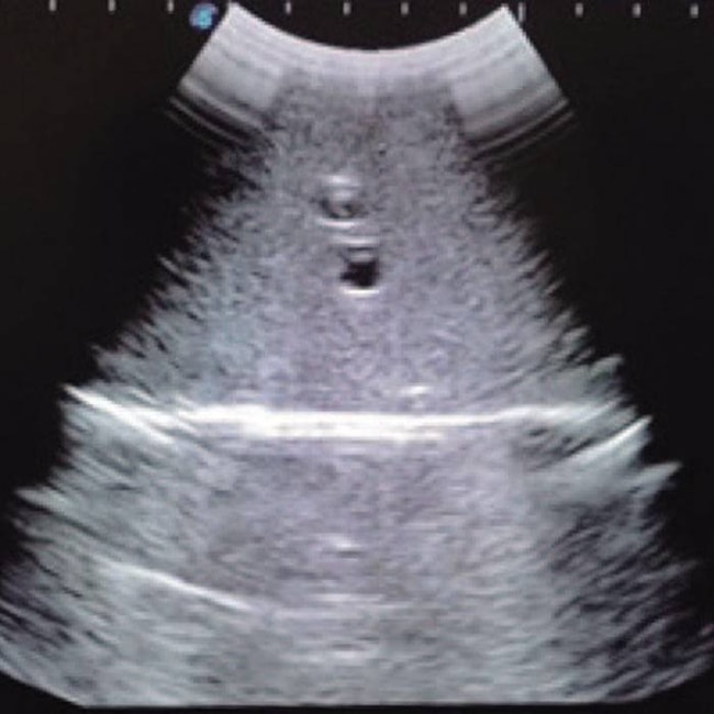 Simulador para Punção Arteriovenosa Femoral e Abdominocentese Guiada por Ultrassom-f5036917-64c3-453d-9b80-eb86aa6aa027