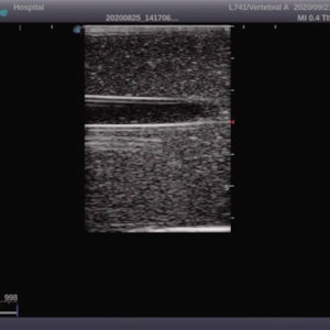 Simulador para Treinamento de Acesso Vascular Guiado por Ultrassom