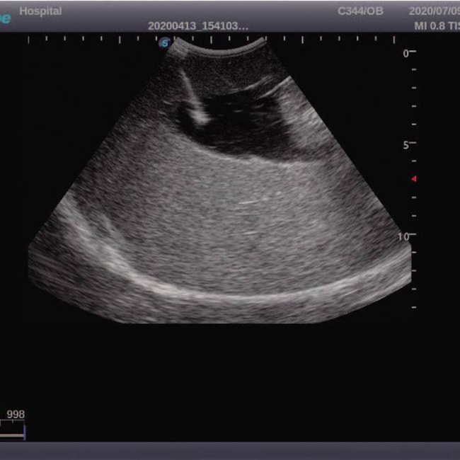 Simulador para Treinamento de Amniocentese Guiada por Ultrassom-307fa0ab-48e7-44d6-a46f-9c7b27b7673f