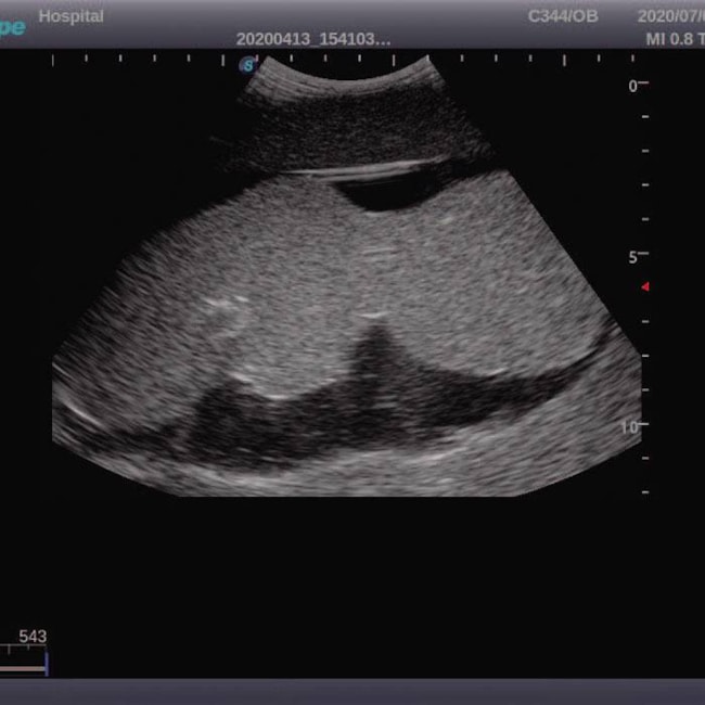 Simulador para Treinamento de Amniocentese Guiada por Ultrassom-73cc58e0-4198-4997-bf47-f82e2fdc1027