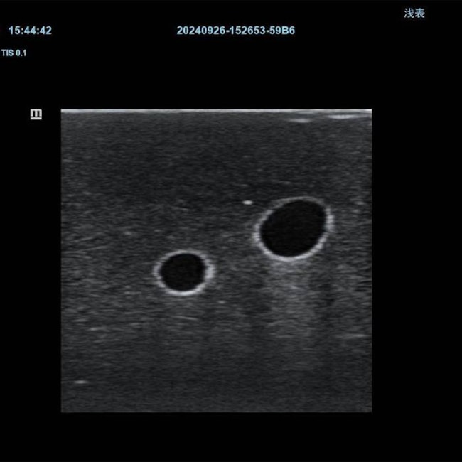 Simulador para Treinamento de Cateter Venoso Central em Jugular Interna Guiado por Ultrassom-3c5b644c-a505-470c-a09e-e847091a9f32