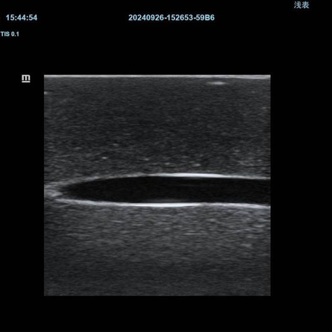 Simulador para Treinamento de Cateter Venoso Central em Jugular Interna Guiado por Ultrassom-4023d903-64d7-434d-96d4-2b6700cd81d5