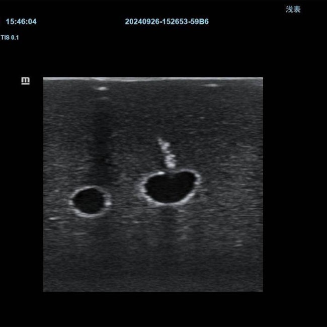 Simulador para Treinamento de Cateter Venoso Central em Jugular Interna Guiado por Ultrassom-f1aac5d0-faed-44fe-834d-0d3eb3609ad3
