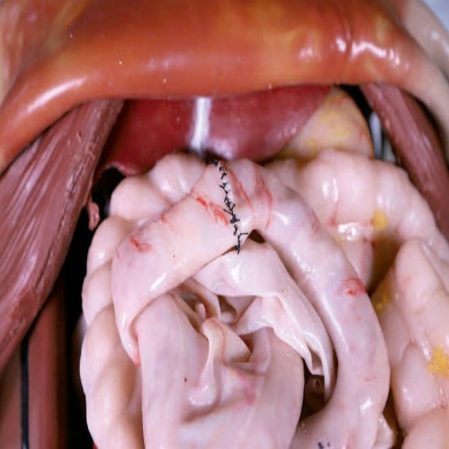 Simulador para Treinamento de Cirurgia Torácica e Abdominal-b462e095-9034-485c-be55-72bac3865750