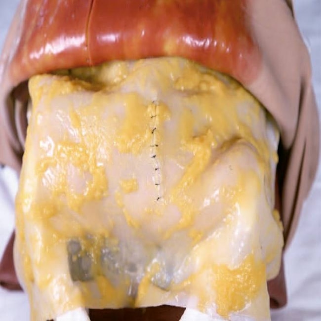 Simulador para Treinamento de Cirurgia Torácica e Abdominal-11380b7a-0cf8-4250-9f25-ca67df549ea7