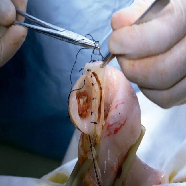 Simulador para Treinamento de Cirurgia Torácica e Abdominal-612c77aa-4011-4447-be42-844603744a16