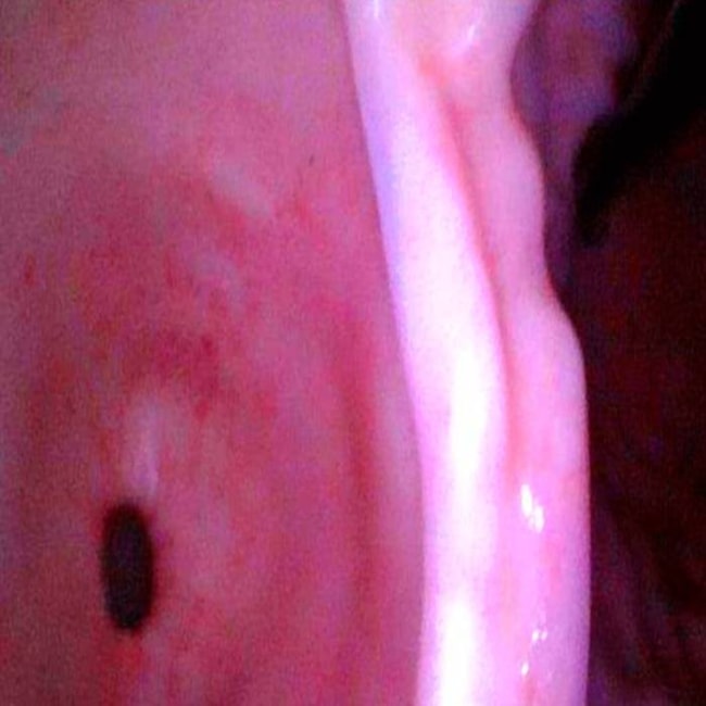 Simulador para Treinamento de Endoscopia Digestiva-c9c3645f-9032-4204-b17e-291fe29c3bf2