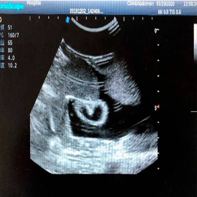 Simulador para Treinamento de Exame Abdominal por Ultrassom-6fb5a5a3-ce3f-4394-95a9-c29b559009b5