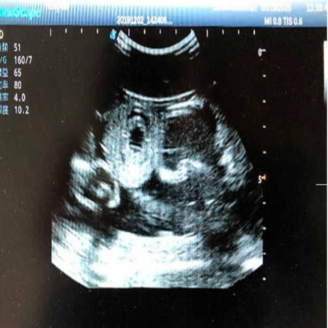 Simulador para Treinamento de Exame Abdominal por Ultrassom-1ee0abb9-3f6f-4df3-9873-d26ab596b05a