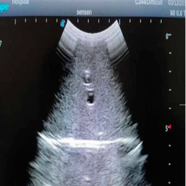 Simulador para Treinamento de Exame Abdominal por Ultrassom-f2208f8d-2619-4b1a-b9e3-e6ee27c8c33d