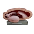 Simulador para Treino de Intubação Traqueal com Visualização das Vias Aéreas-b85d0fe1-8d91-4788-ba74-43f315cf13d6