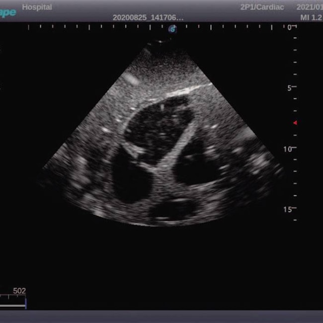 Simulador Torso Phantom para Treinamento de Ultrassonografia-a6762646-2d0d-4c5a-9b0c-abc43e4d3657