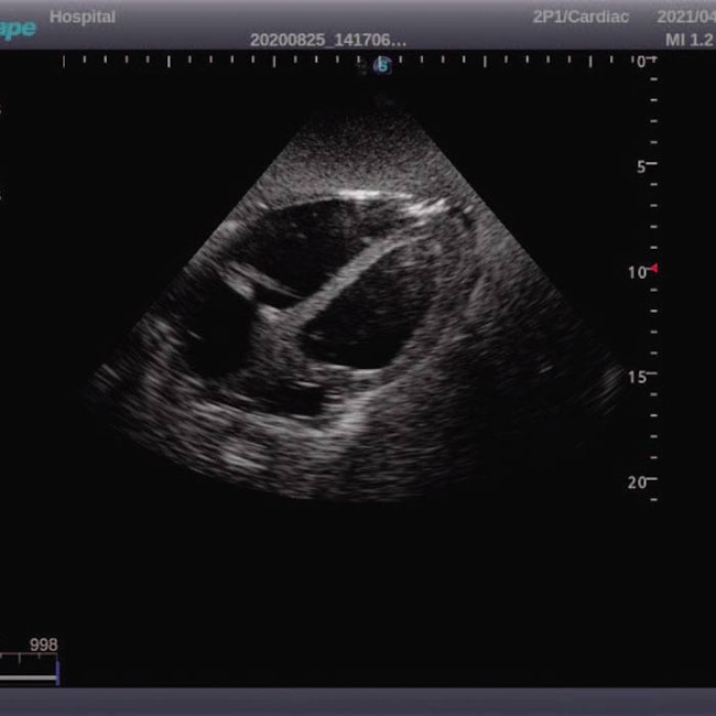 Simulador Torso Phantom para Treinamento de Ultrassonografia-9781537c-e360-4efe-89d6-15659941f564