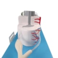 Sistema da Medula Espinhal Ampliado-9b3671da-aa7d-45f1-a49f-0d52e2b56876