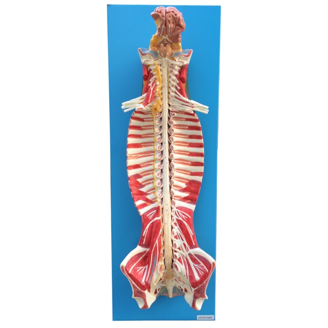 Sistema de Medula Espinhal Em Seu Canal-4808c0cc-6b18-4474-b239-3cae45dd6d4d