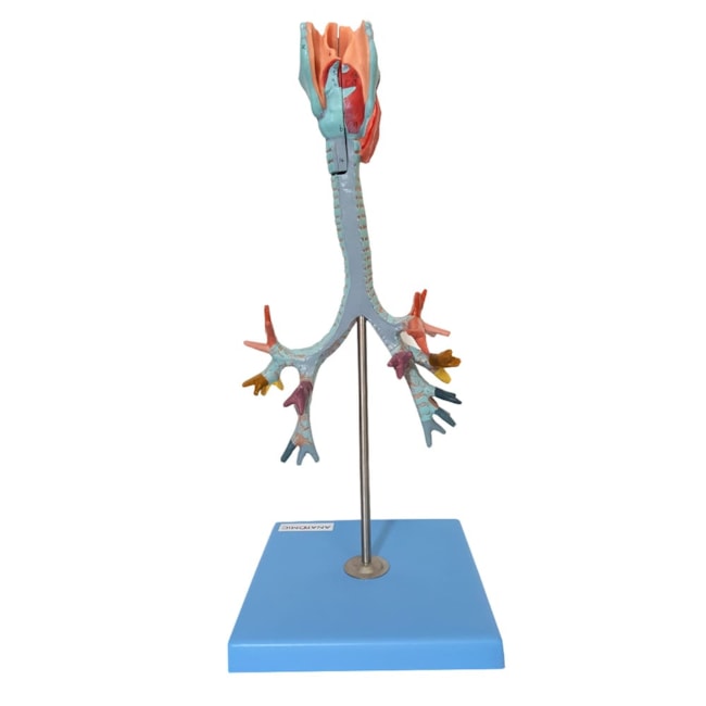 Traqueia Laringe e Árvore Brônquica-0b15b3e5-0a15-4d1d-8227-39df266ed6f0