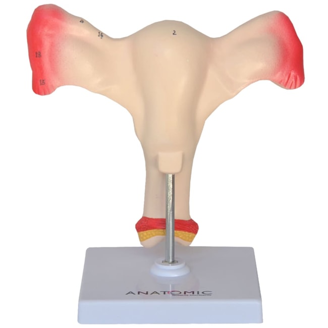 Útero com Trompas-105c8566-6728-48cb-8afe-c2b1ac3355a7