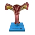 Útero com Trompas-efc005ae-d227-4ee0-8b63-941049225638