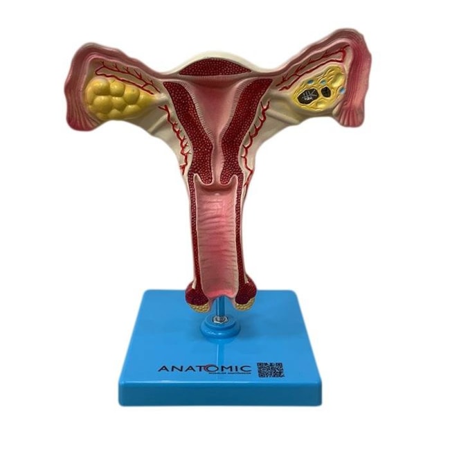 Útero com Trompas-d8a070c8-8724-4a50-8f84-1a7a18cfd6ea