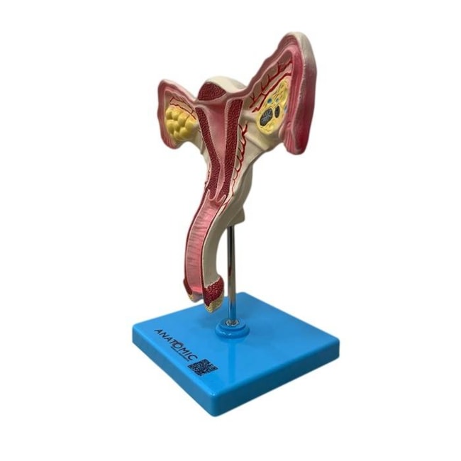Útero com Trompas-dbdbd9c9-fc18-4d53-b6ba-a617a3b2075f