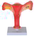 Útero com Trompas-9c121fc0-0c59-45cd-be1e-0a276f260288