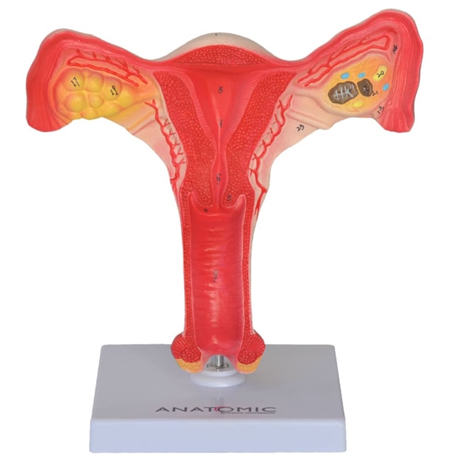 Útero com Trompas-3cb505ec-f598-44d9-b3da-83ff45218391