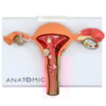 Útero com Trompas Patológico-e81726af-e98c-4ba6-8169-d92e863e93d5