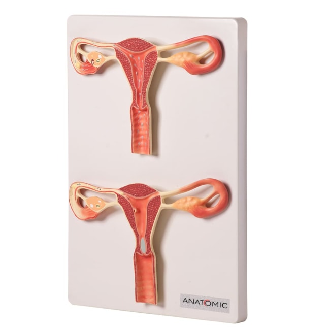 Útero Ilustrando o Momento da Fecundação-7a93410d-8170-4b52-b8e1-015e0eb9a502