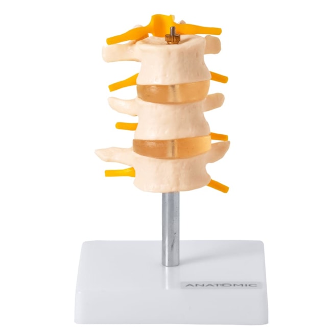 Vertebras Lombares 3 Peças-f5055d9c-1e1e-49e6-99b5-793079b33a9b